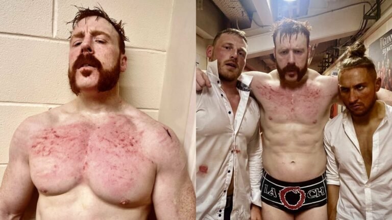 Sheamus’ chest looked raw after Gunther battle